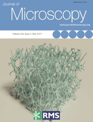 cover J Micros 2017, no. 2